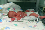 NICU Bed